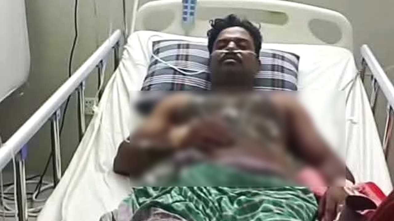 ‘লজ্জা ও সমালোচনার’ মুখে হাসপাতাল ছাড়লেন সেই সাপুড়ে