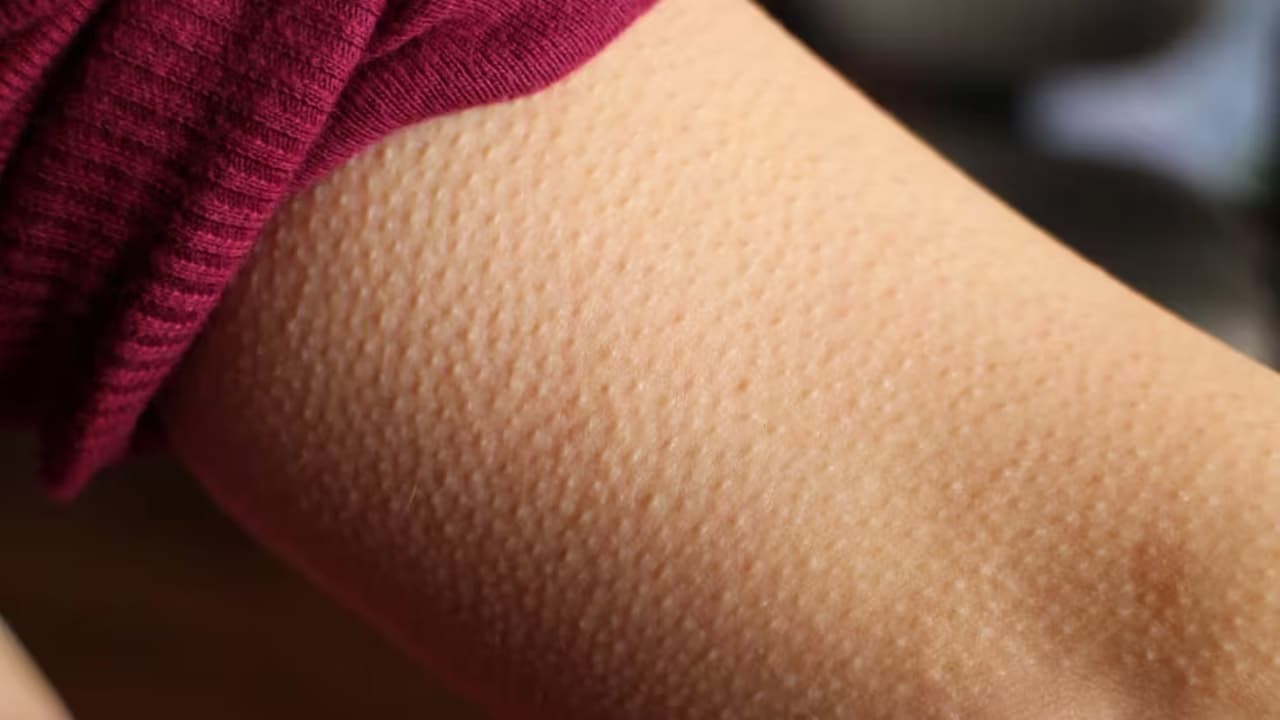 ভয় বা প্রিয় গান শুনে গায়ে কাঁটা দেয় কেন?