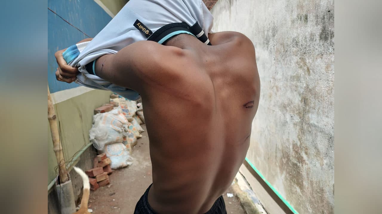 কুষ্টিয়ায় মাদ্রাসায় হেফজ শিক্ষার্থীর নির্যাতনের অভিযোগ, ইমো কলে পরিবারের কাছে আকুতি
