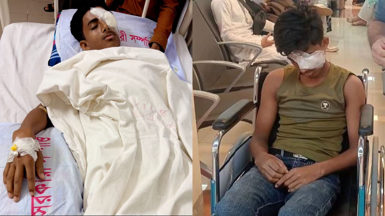 রাজনৈতিক সংঘর্ষে দৃষ্টিশক্তি হারালেন শিক্ষার্থী আলিফ, অনিশ্চিত ভবিষ্যৎ