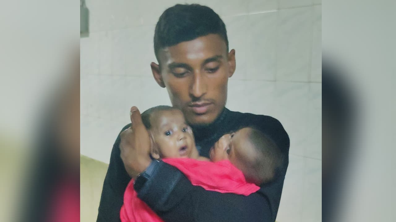 জোড়া লাগানো দুই শিশুর চিকিৎসার সম্পূর্ণ দায়িত্ব নিল সরকার
