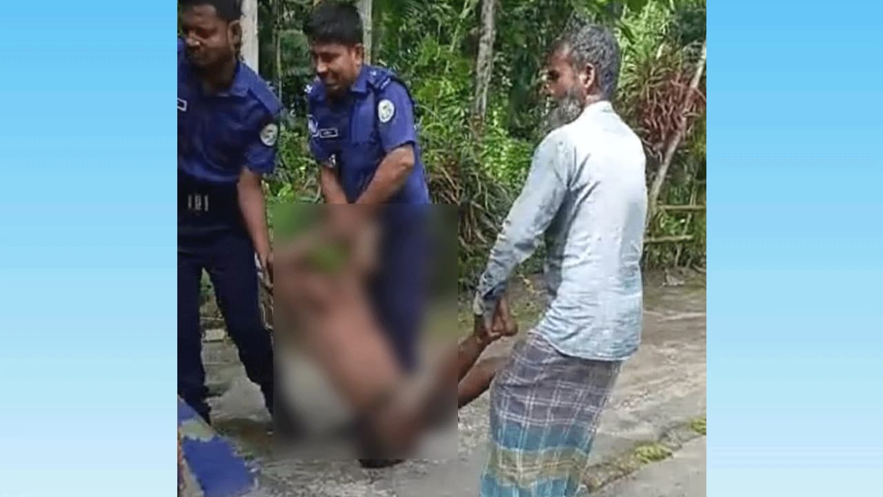 ডাব চুরিতে গাছ থেকে পড়ে চোর, ভিমরুলের কামড়ে আহত