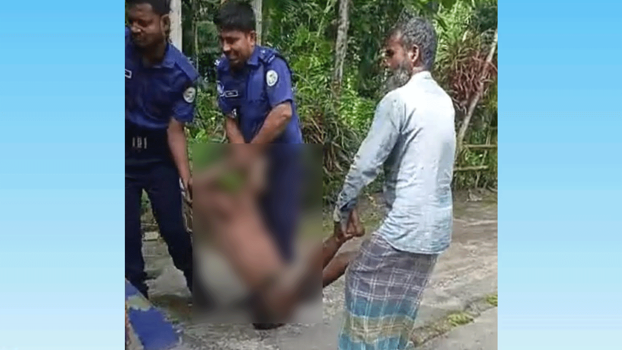 ডাব চুরিতে গাছ থেকে পড়ে চোর, ভিমরুলের কামড়ে আহত