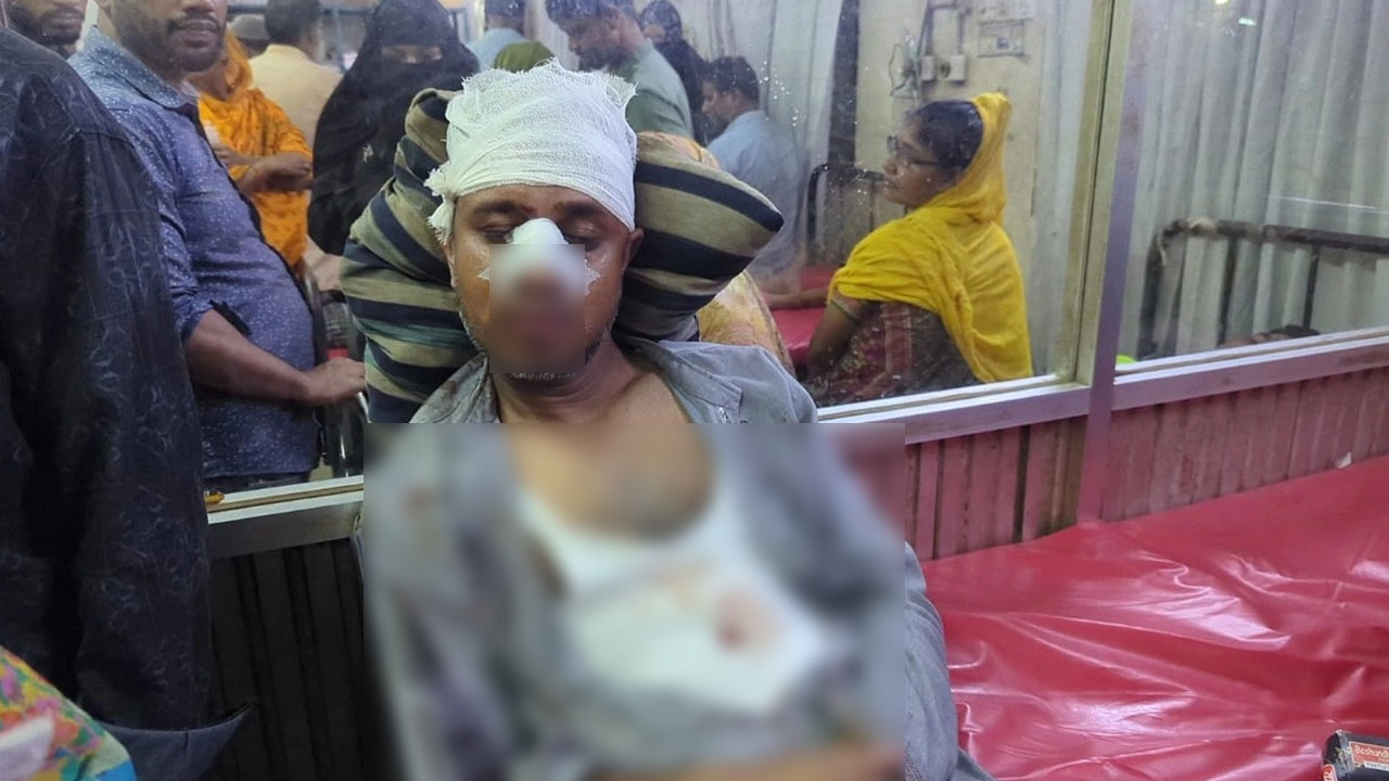 ফতুল্লায় জামায়াত নেতাকে মারধর ও ছুরিকাঘাত করা হয়েছে