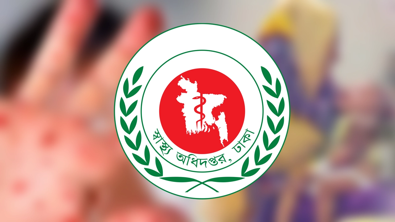 হাম উপসর্গে আরও ৮ শিশুর মৃত্যু