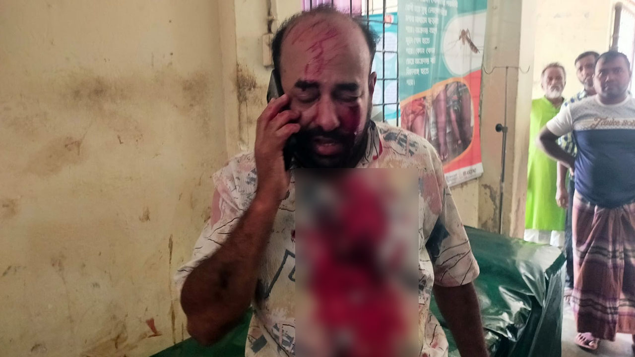 কুষ্টিয়ায় এমপি'র স্বজনদের হামলায় আহত সাংবাদিক