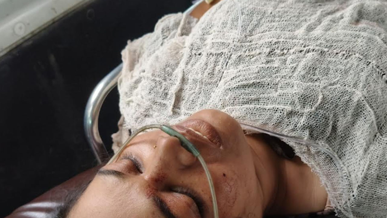 ঝিনাইদহে ট্রেনে ওঠার সময় দুই পা হারালেন নারী