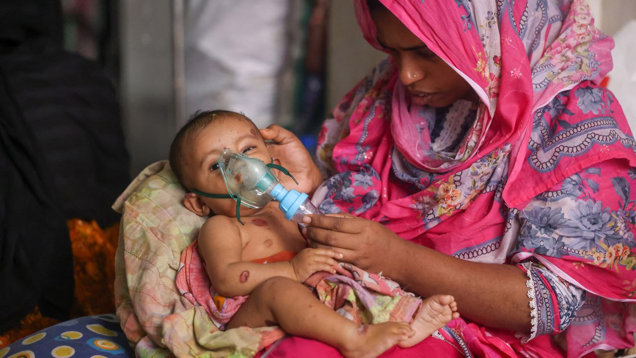 হাম উপসর্গে আরও ৯ শিশুর মৃত্যু